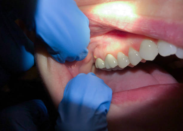 Best Pediatric Emergency Dentist in Bridgetown, MS